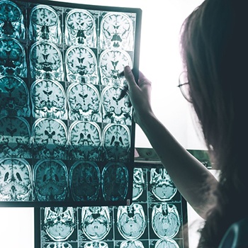 Certificación en la Enfermedad de Alzheimer