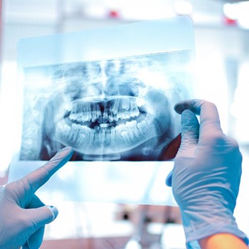 Anatomí­a y Fisiopatologí­a de las Enfermedades Tratadas con Radiaciones Ionizantes